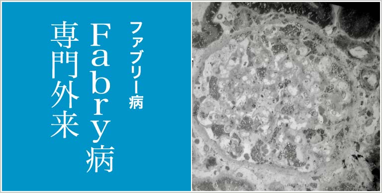 ファブリー病 Fabry病専門外来