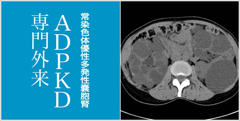 常染色体優性多発性嚢胞腎 ADPKD専門外来
